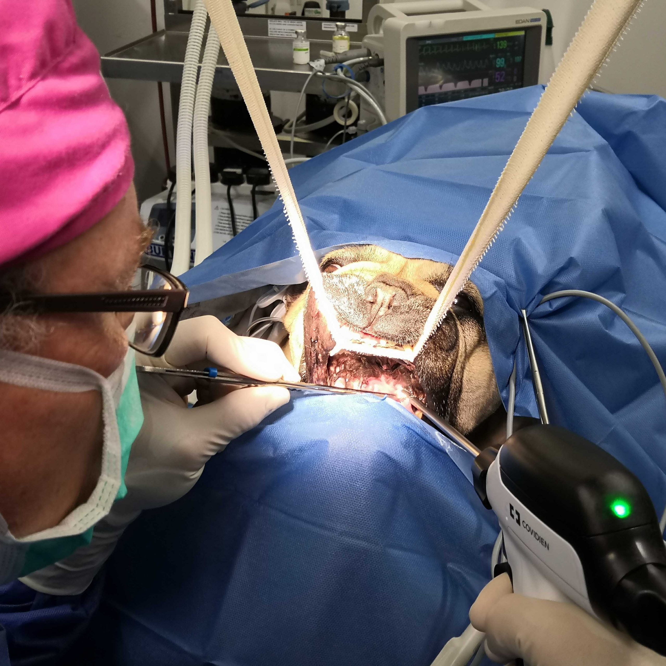 Folding flap palatoplasty and a new toy